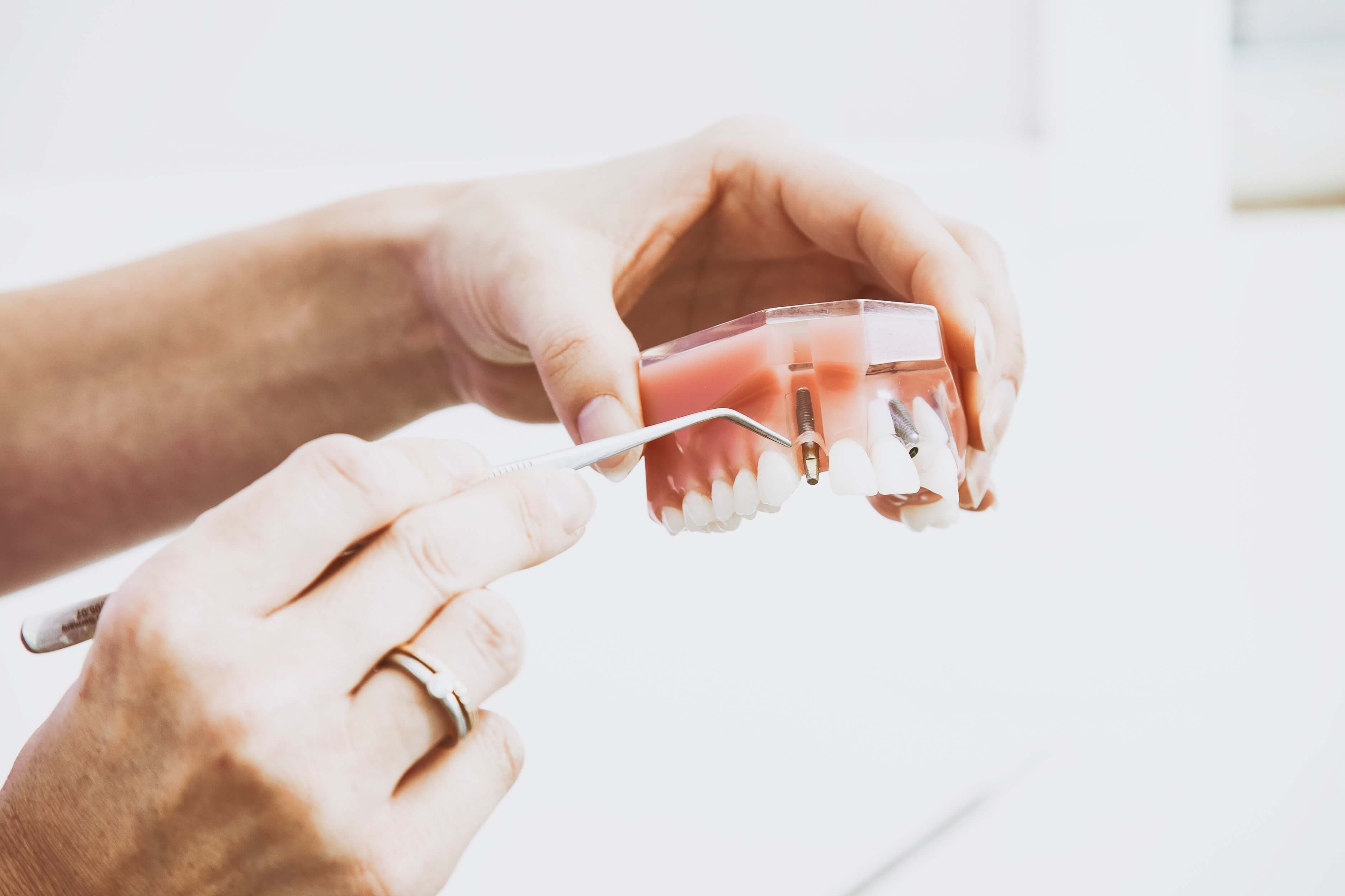 Dental Implant Edmonton